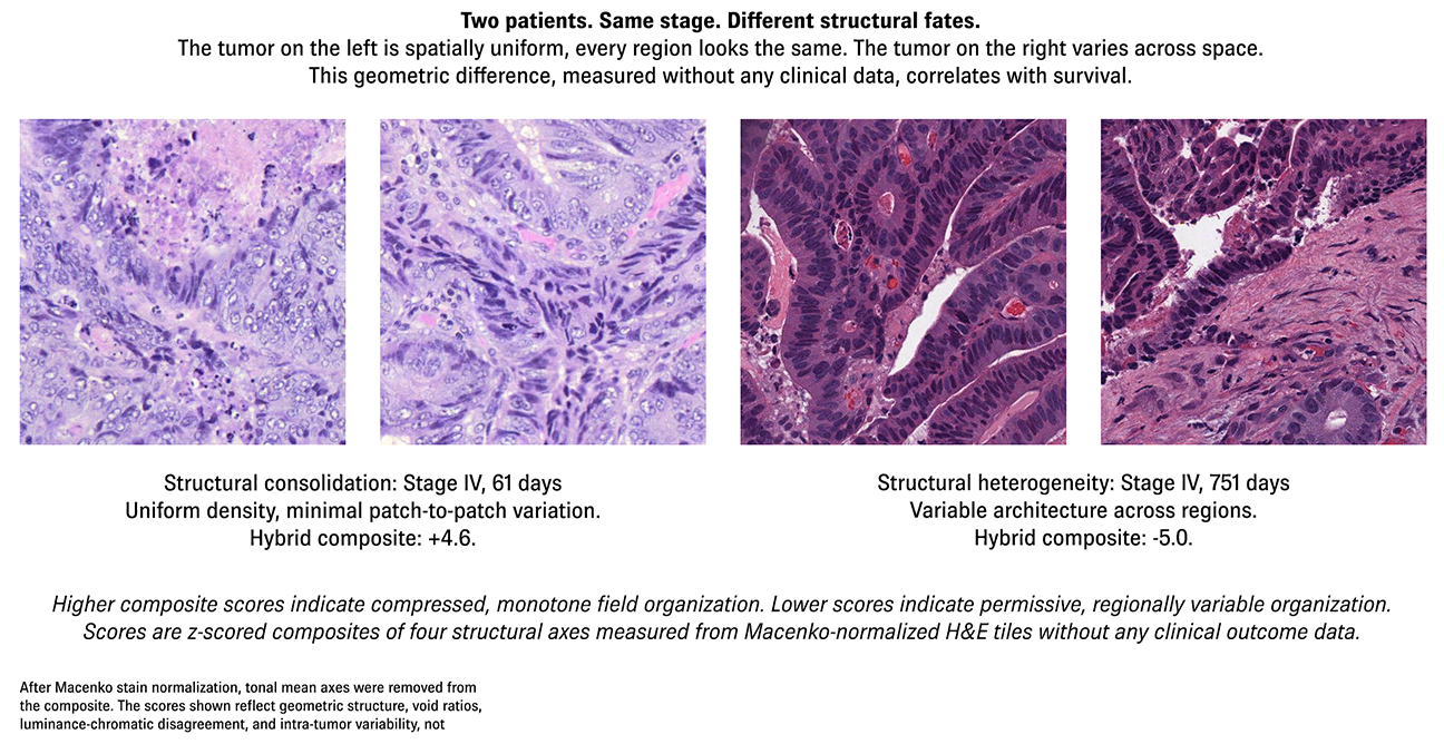 Two TCGA-COAD patients with divergent structural organization